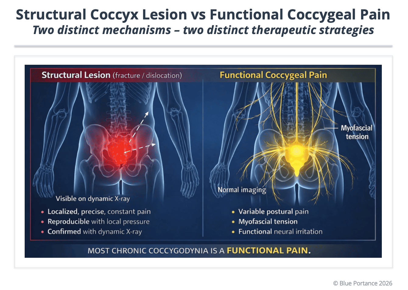 Comparison between structural and functional coccydynia: objective mechanical abnormality versus myofascial constraint without visible bony lesion